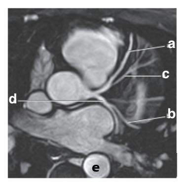 <p>Which letter is the descending thoracic aorta ?</p>