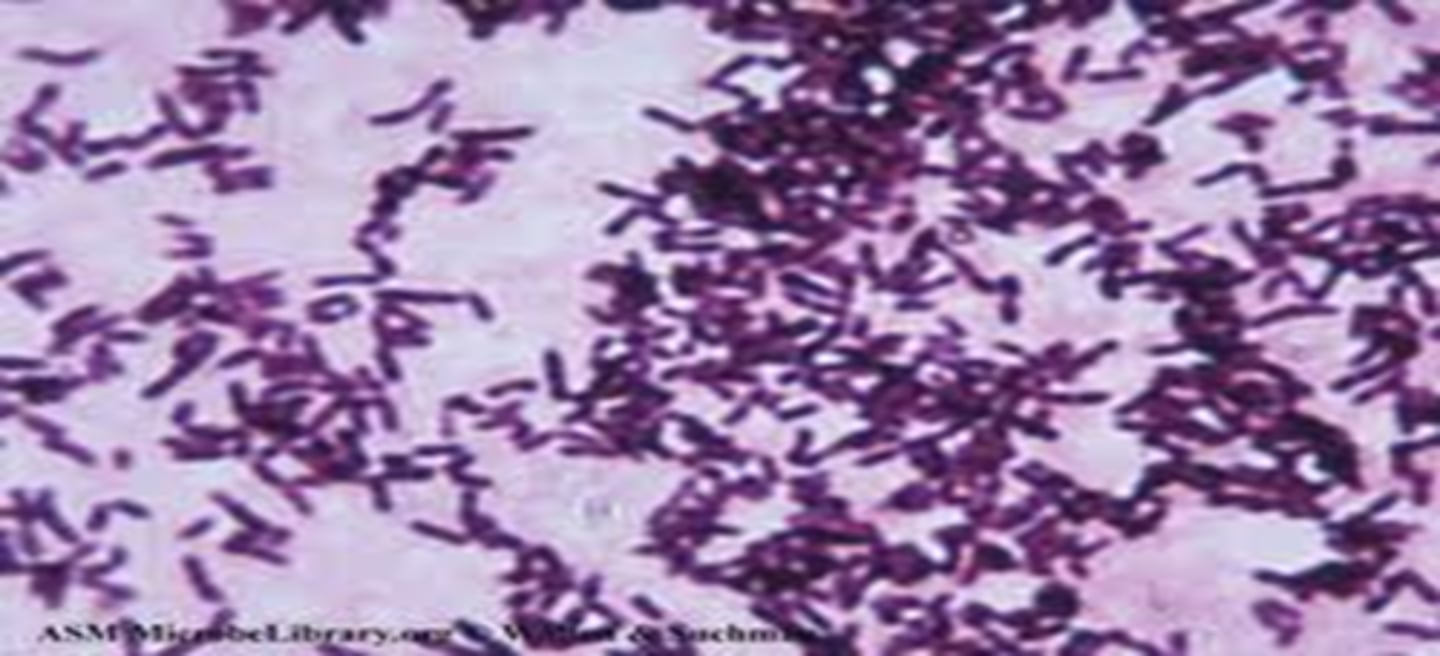 <p>- spirilla (spirals)</p><p>- purple = positive</p><p>- arrangement: streptospirilla, staphylospirilla, diplospirilla</p>