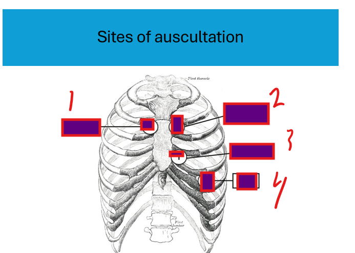 <p>where is tricuspid&nbsp;</p>