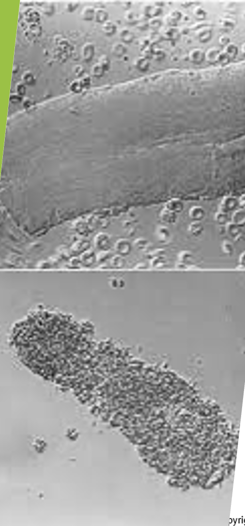 <p><span>Gives three-dimensional images, but high cost prevents use by most laboratories</span></p>