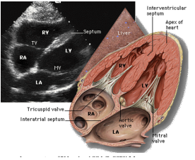 <p>What does the subxiphoid view show?</p>