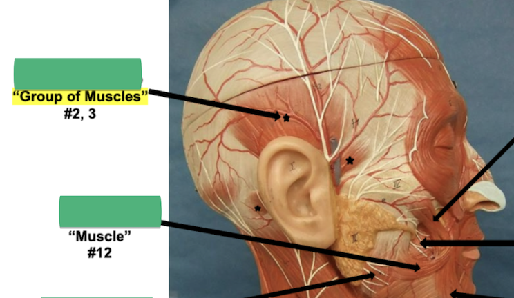 <p>Label “Group of Muscles”</p>