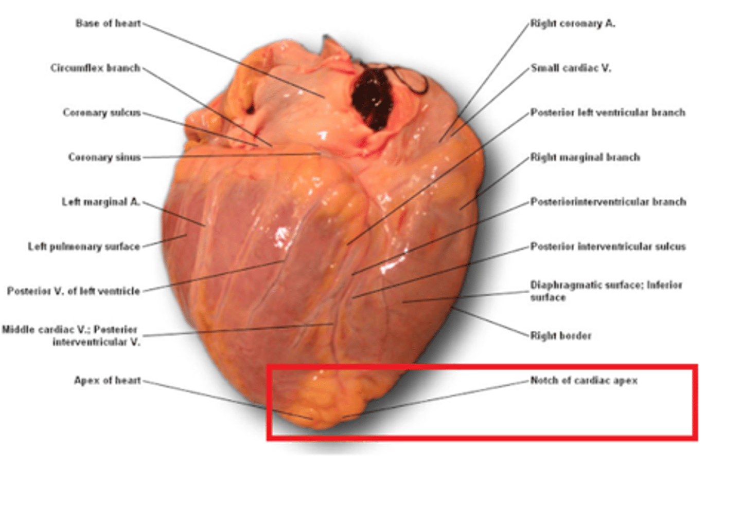 <p>notch of cardiac apex</p>