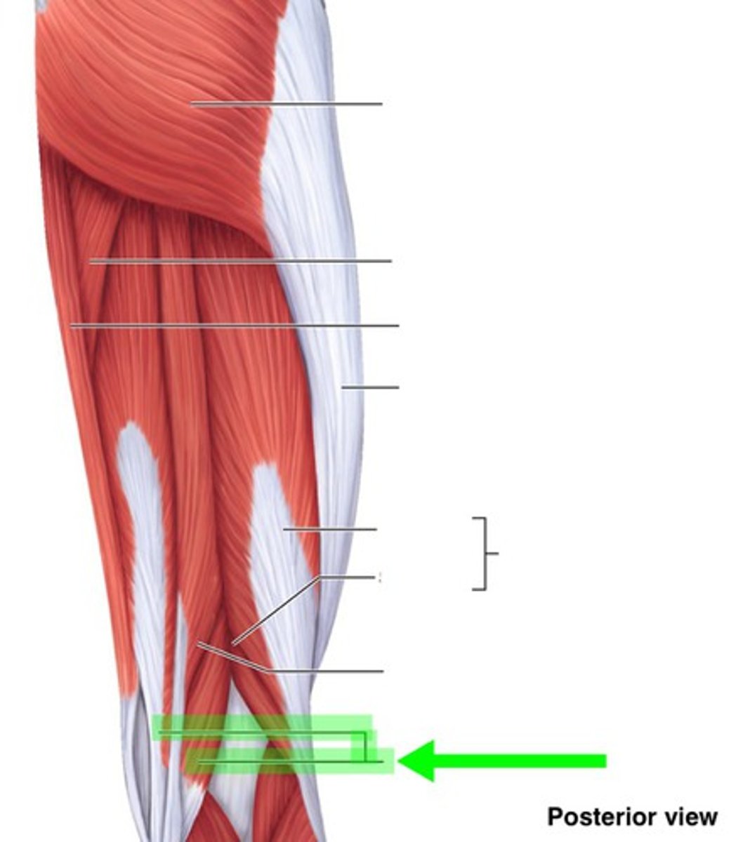 <p>What muscle is this?</p>
