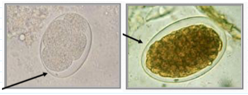 <ul><li><p><span>60 x 40 um eggs</span></p><ul><li><p><span>Smaller than Trichostrongylus spp</span></p></li></ul></li><li><p><span>Thin, smooth, transparent, colorless shells</span></p></li><li><p><span>Yolk cells retract leaving clear space</span></p></li><li><p><span>Often difficult to see</span></p></li></ul><p></p>