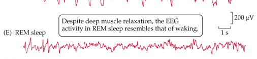 <ul><li><p>Occurs about <strong>1 hour after sleep onset</strong>.</p></li><li><p>EEG shows <strong>small amplitude, high frequency activity</strong> (similar to wakefulness).</p></li><li><p>Rapid eye movements occur.</p></li><li><p><strong>Muscle tone is lost</strong> (atonia), but brain is highly active.</p></li><li><p>Breathing and pulse are irregular, like wakefulness.</p></li><li><p>Most <strong>vivid dreams</strong> occur during REM.</p></li></ul><p></p>