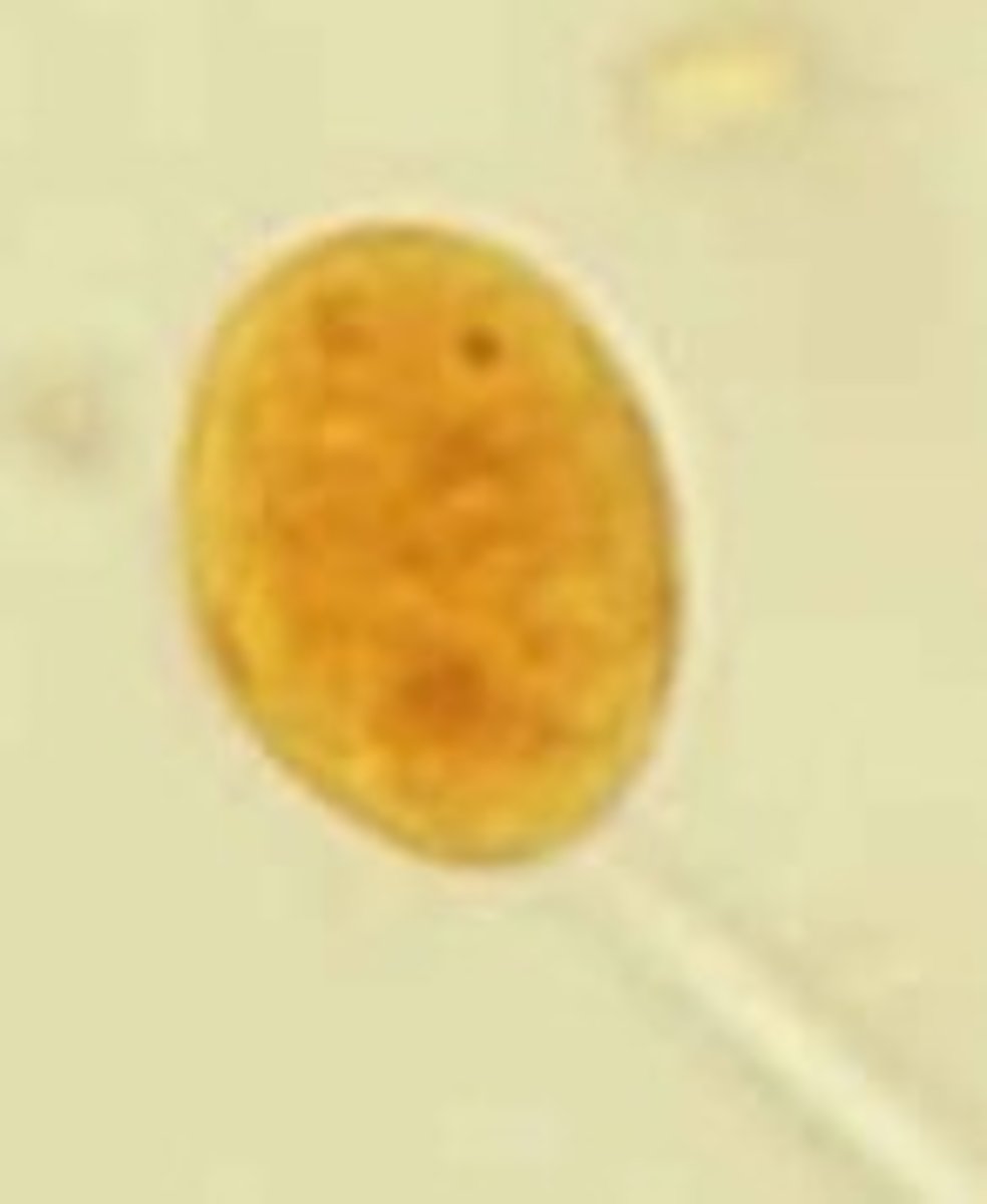 <p>Identify the parasite</p>