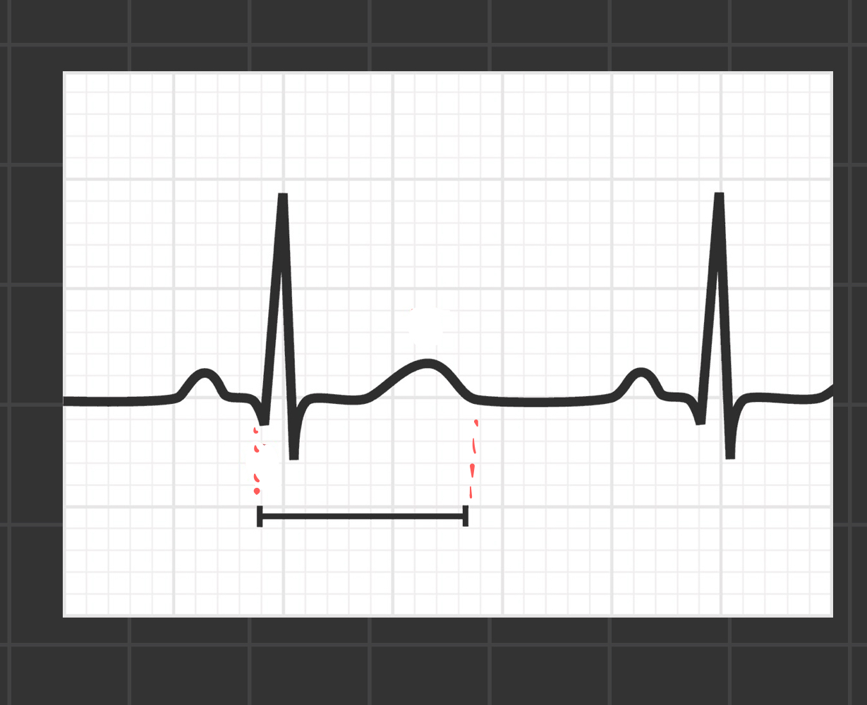 <p>what segment is this</p>