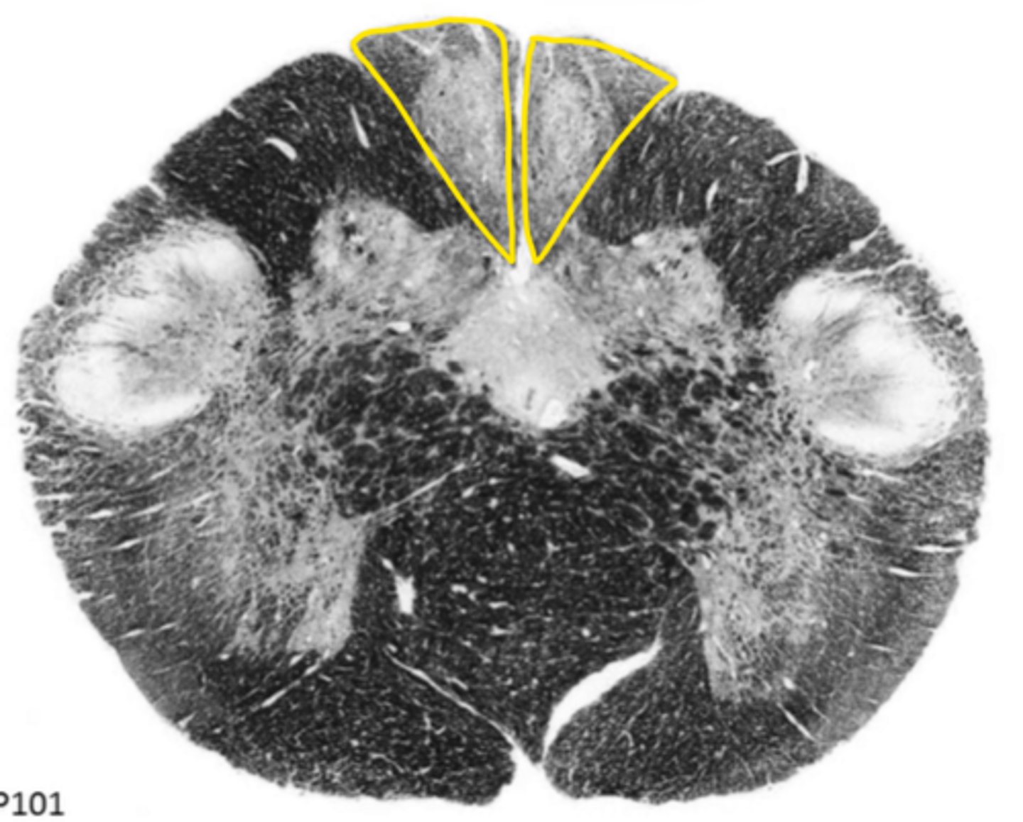 <p>ID the light area</p>
