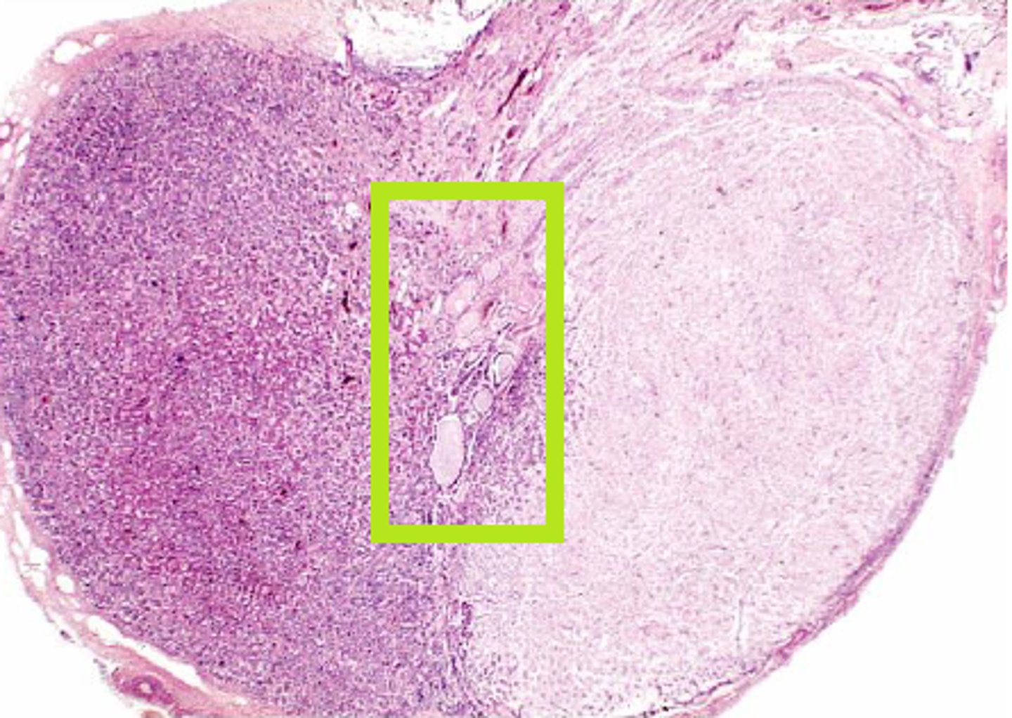 <p>What part of the pituitary:</p><p>-posterior portion of the anterior pituitary</p><p>-in contact with neural tissue</p><p>-most active during fetal development</p>