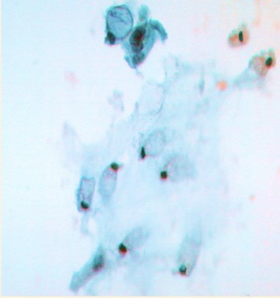<p>Células epiteliales glandulares caliciformes disociadas del epitelio </p>