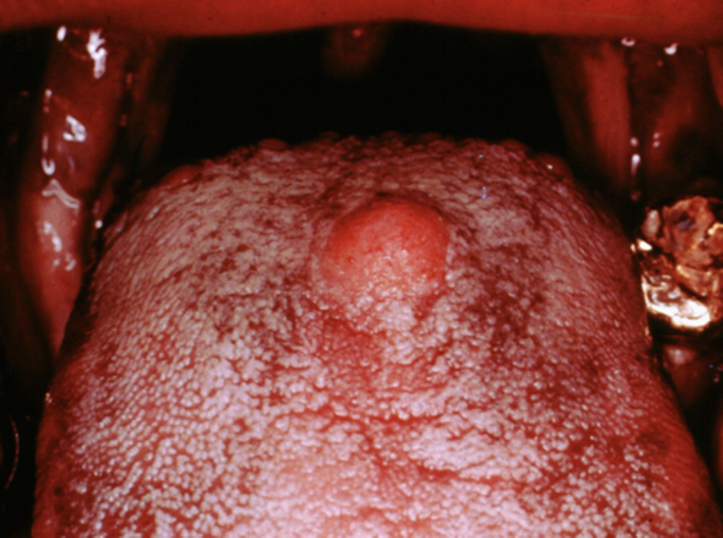 <p>tongue</p>