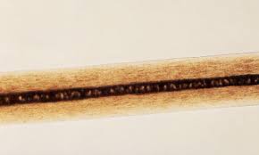 Human Medulla