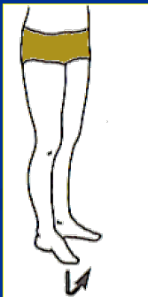 <p>What Movement is occurring?</p>