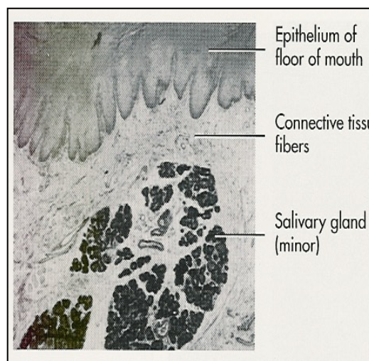 <ul><li><p>non-keratinized, <strong>thin</strong></p></li><li><p>Lamina propria → highly vascularized, not very many rete ridges/CT papillae </p></li><li><p>Submucosa → loosely attached to bone/muscles; submand. and sublingual salivary glands found here</p></li></ul><p></p>