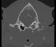 <p><span><span>Which side is abnormal?</span></span></p>
