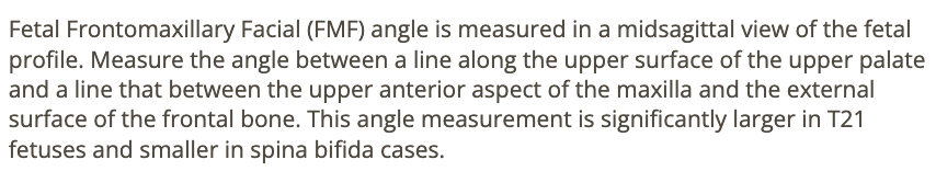 <p>b) is measured in fetuses w/suspected trisomy 21</p>