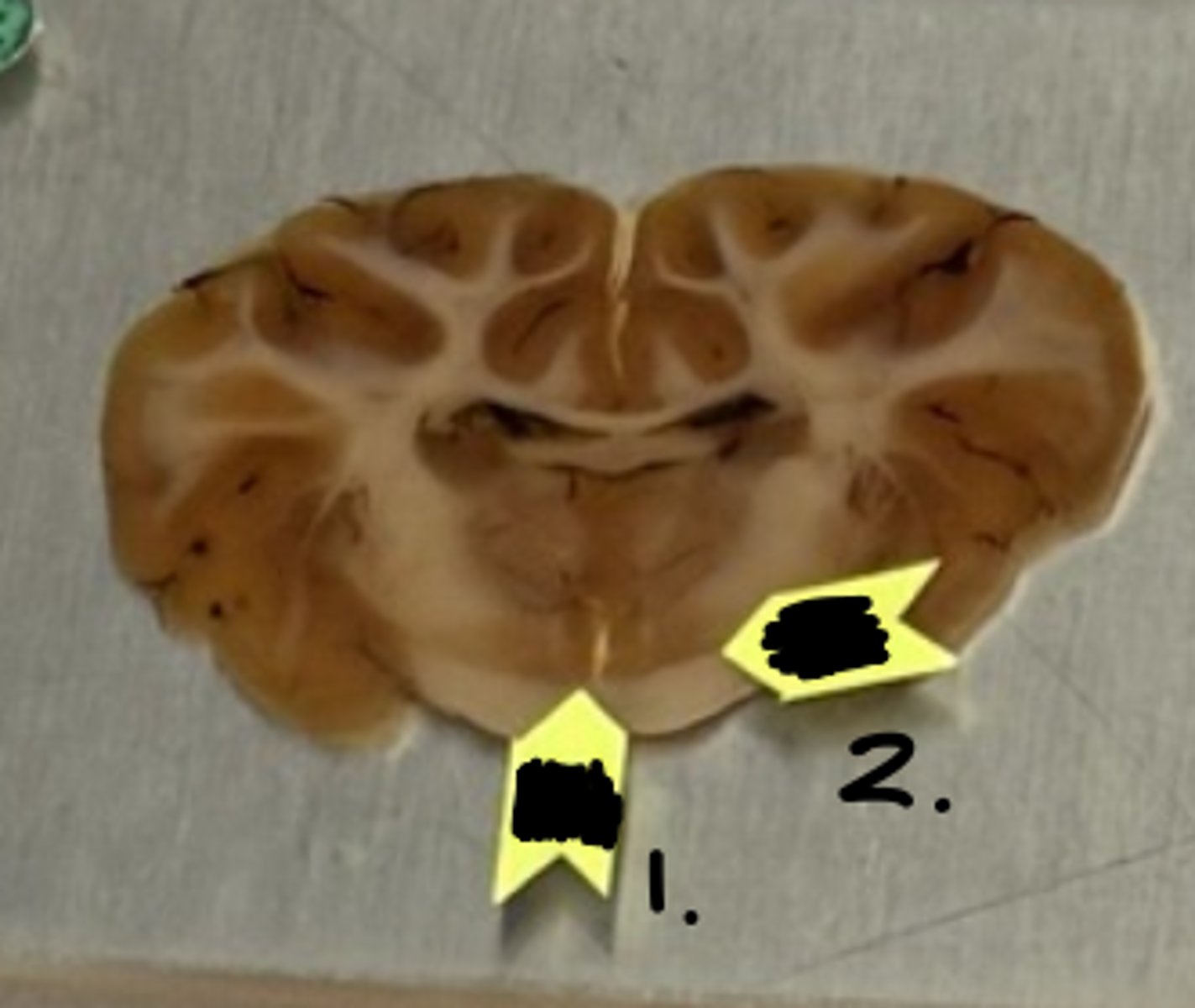 <p>what structure is labeled as #2 ?</p>