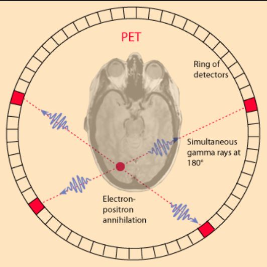 <p><span>What is needed in order for the <strong>PET </strong>detectors to determine where an <strong><em>annihilation reaction</em></strong> occurred on a <strong><em>line of response</em></strong>?</span></p>