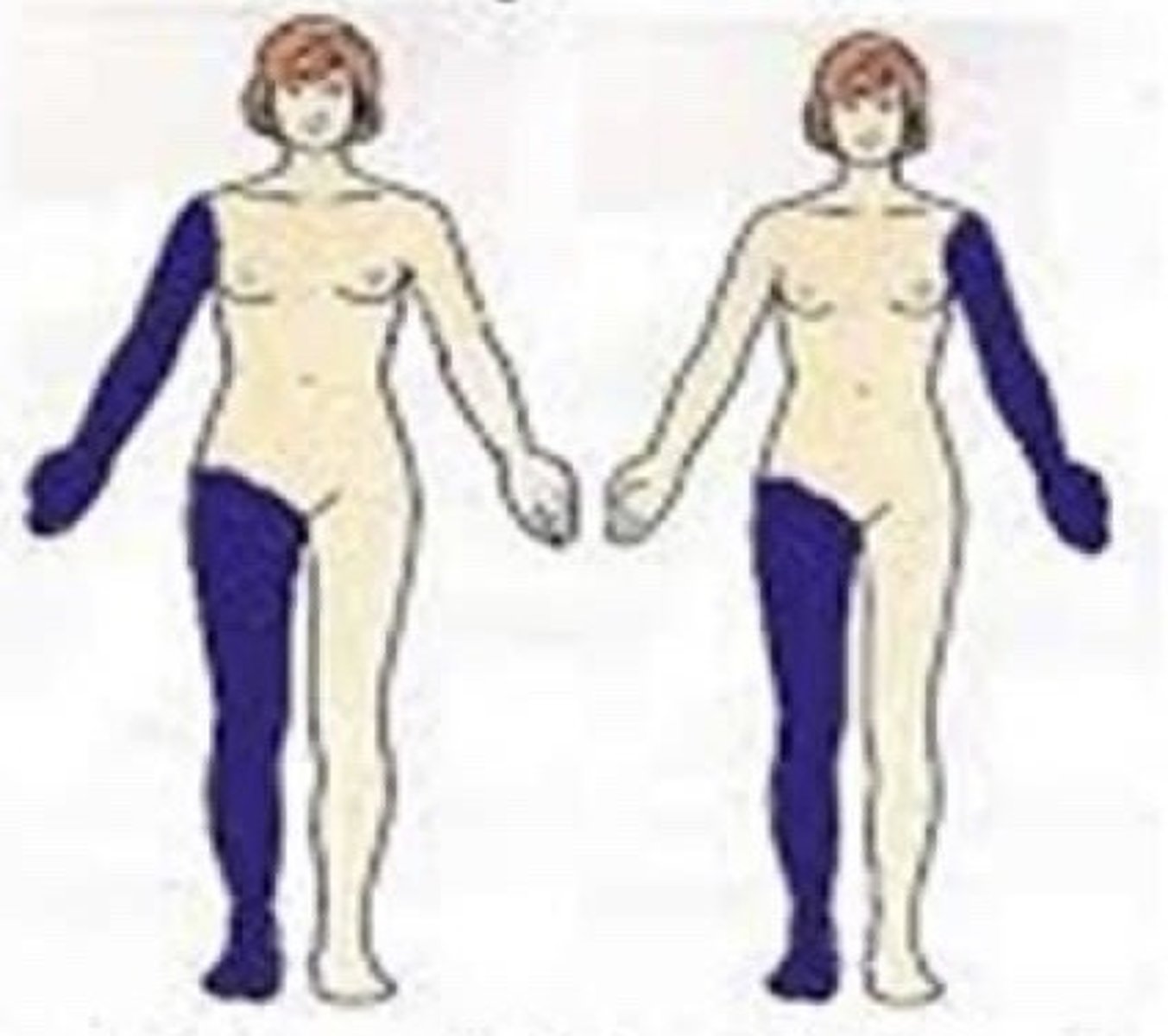 <p>same side vs opposite side</p>