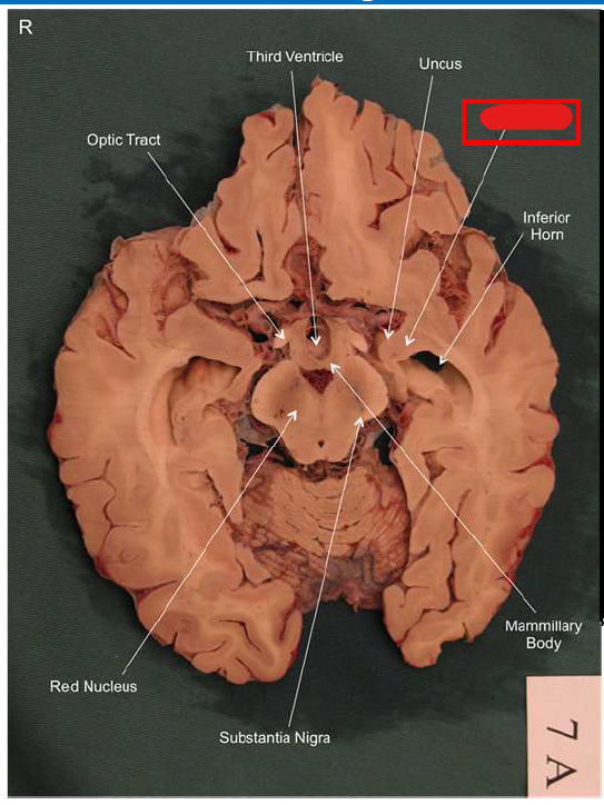 term image