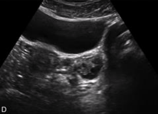 <p>What is shown in this image?</p>