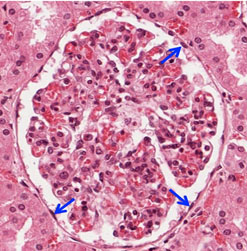 <p>What is this tissue?</p>