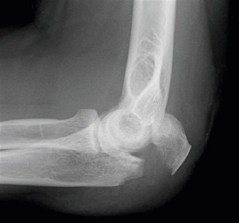 <p>What kind of pathology is shown in the image?</p>
