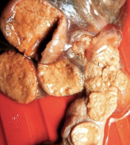 <p>10% non-buffered formalin:</p><p>-placenta (multiple sections)</p><p>-lung</p><p>-liver</p><p>-heart</p><p>-skeletal muscle (tongue, diaphragm)</p><p>-kidney</p><p>-brain 1/2</p><p>-eyelid</p>