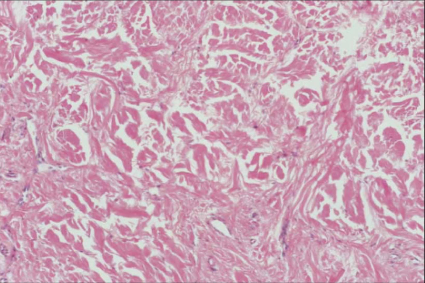 <p>dense irregular connective tissue</p>