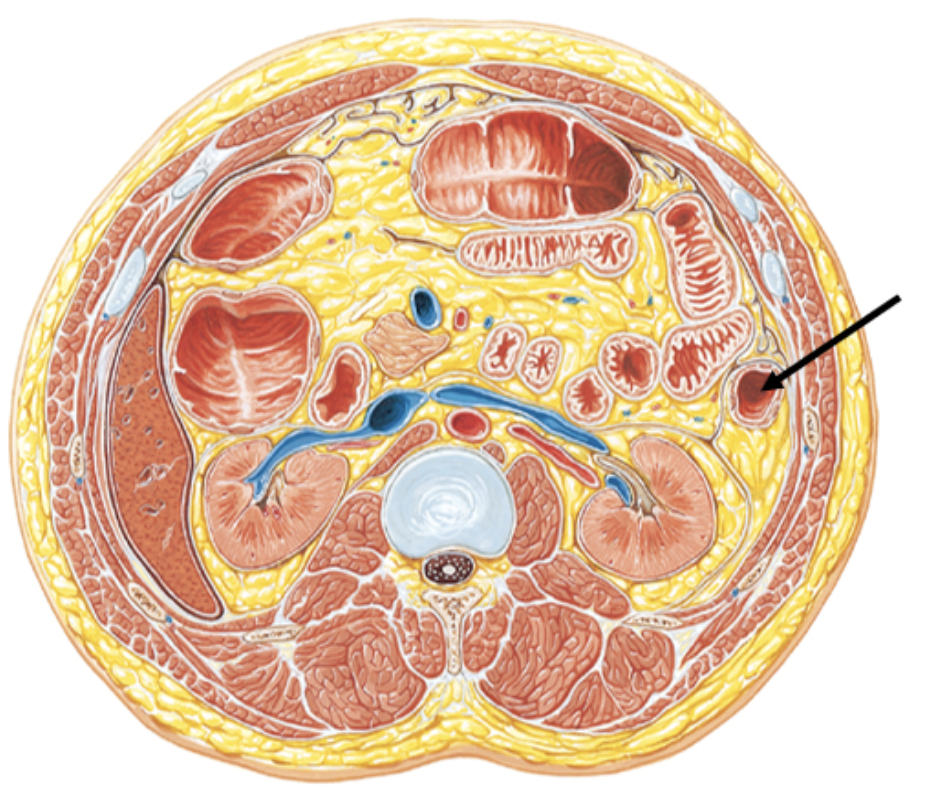 <p><span>Which of the following gastrointestinal segments is distal to the tagged structure?</span></p>