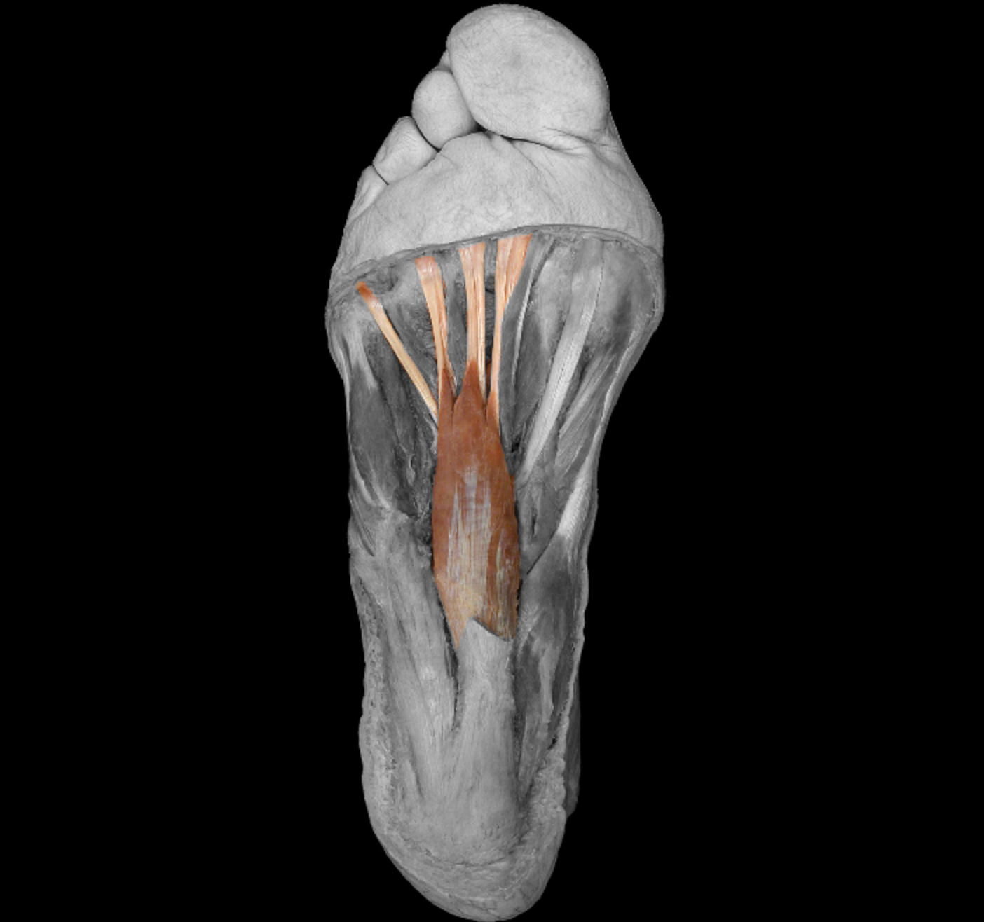 <p>origin: calcaneus, plantar aponeurosis, flexor retinaculum </p><p></p><p>insertion: middle phalanx toes II-V </p><p></p><p>action: flex toes </p><p></p><p>innervation: media plantar nerve </p>