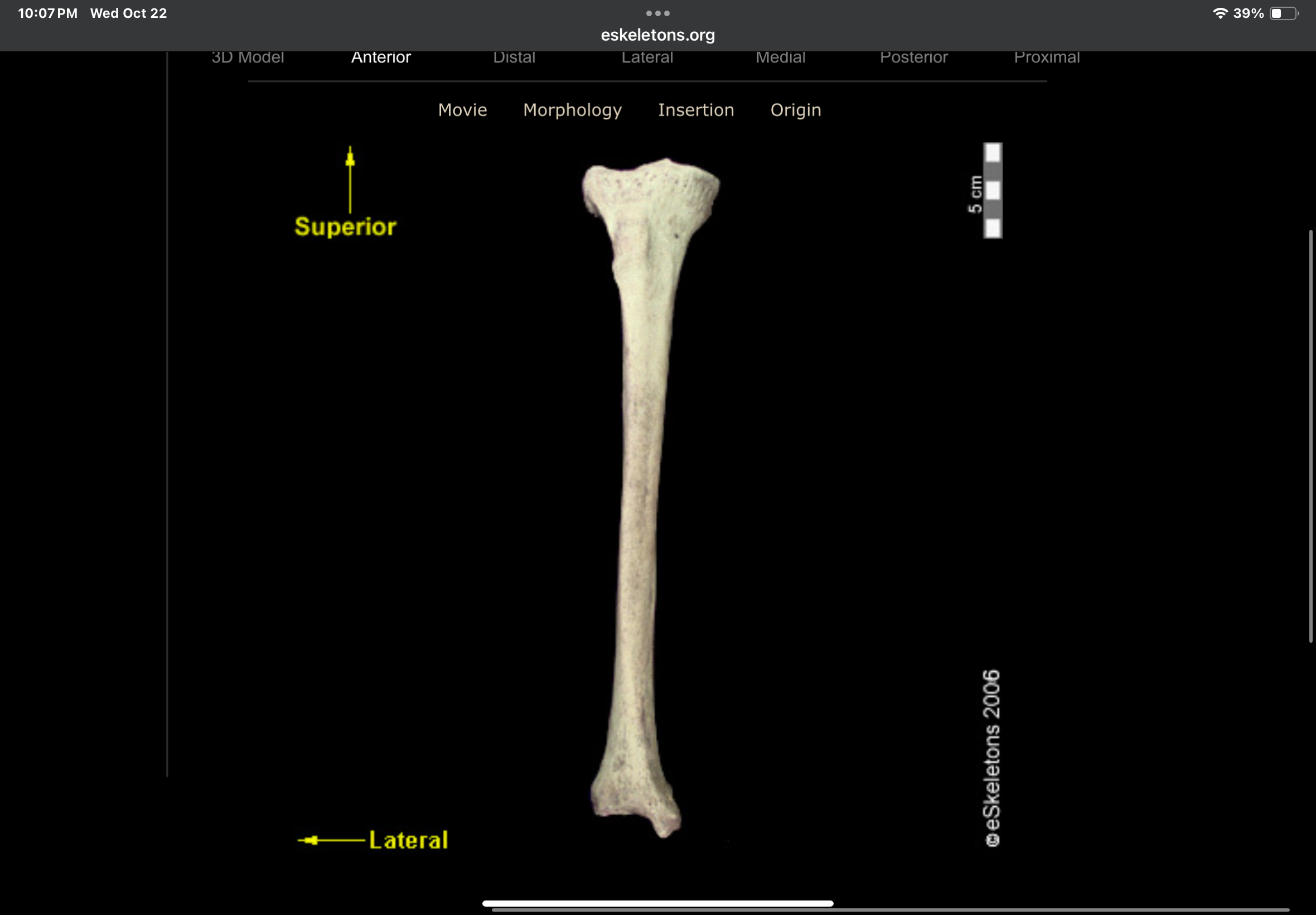 <p>Bone?</p>