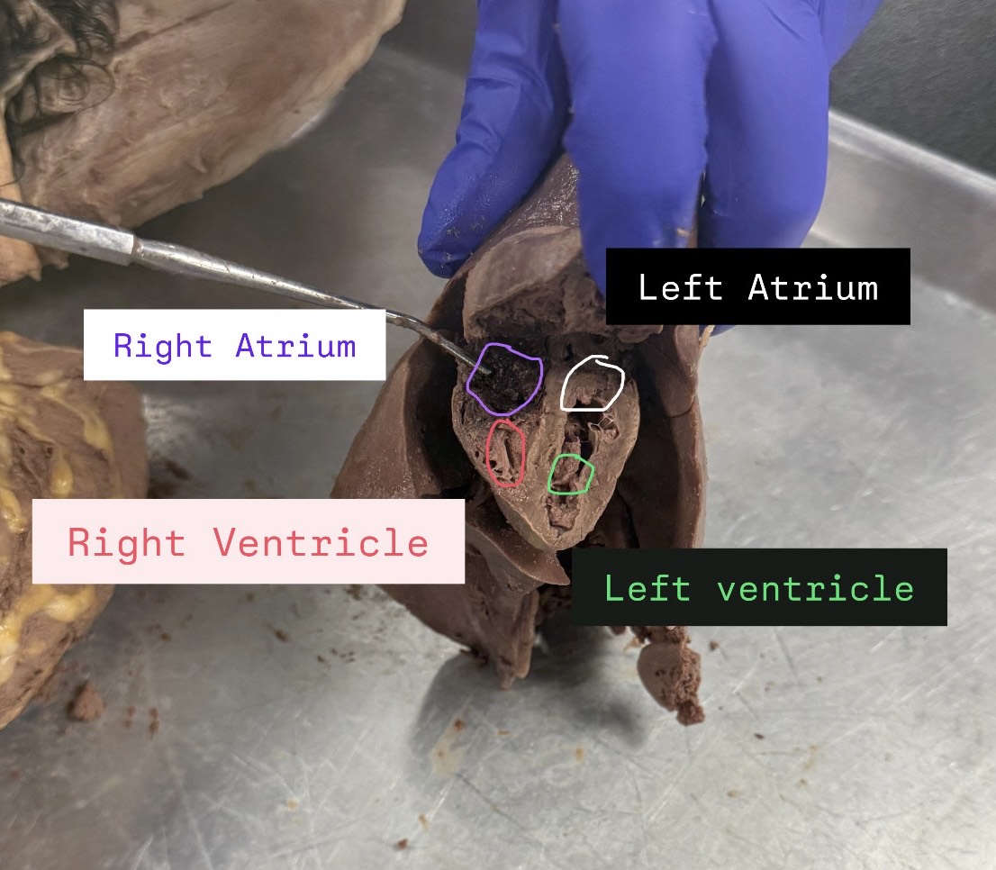 <p>Right atrium, Left atrium, right ventricle, left ventricle</p>