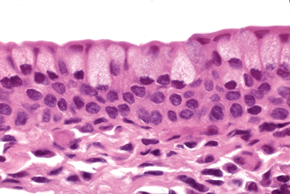 <p>located in the posterior surface of the eyelid, that is in contact with the surface of the eyeball, is lined by stratified columnar epithelium</p><p>also in exocrine glands</p><p>not common</p>