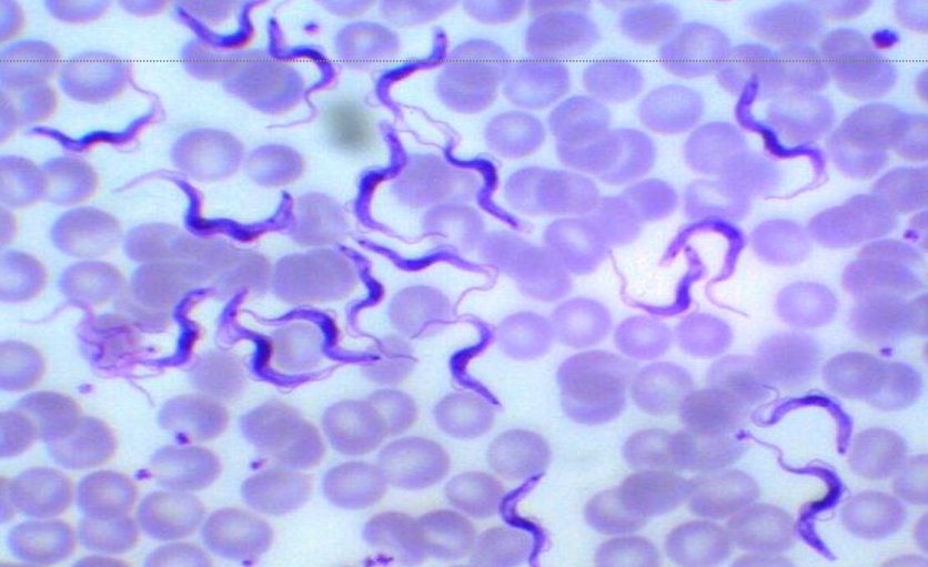 <p>rhodesiense = E. African sleeping sickness → more rapid onset, death</p><p>gambiense = W. African sleeping sickness → recurring fever w lymphadenopathy, Winterbottom sign</p><p></p><p>vector = <u>tsetse</u> fly</p><p><span style="color: red">IS = metacyclic trypomastigotes</span></p><p>dx: see trypomastigote (pic’d) in body fluid, tissue, LN, blood → if dx, must examine CSF for CNS involvement</p>