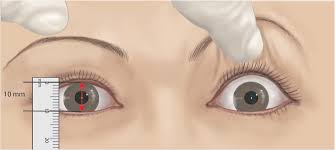 <p>The opening between the eyelids  </p>