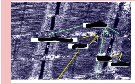 <p>Identify strcutures in the image</p>