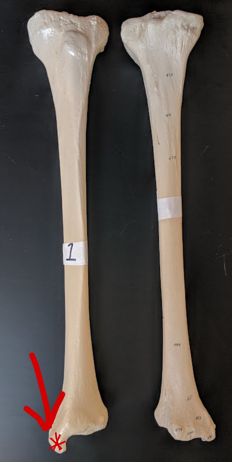 <p>Name this structure</p>