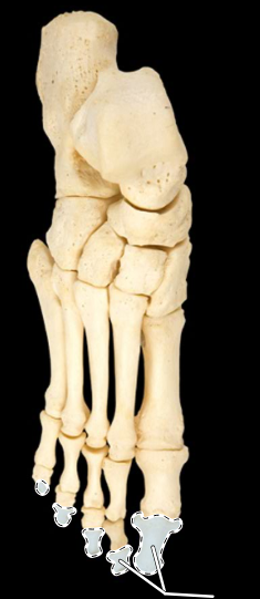 <p>Bones of the foot, superior view, right side</p>