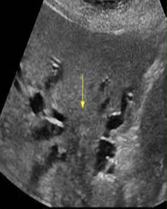term image
