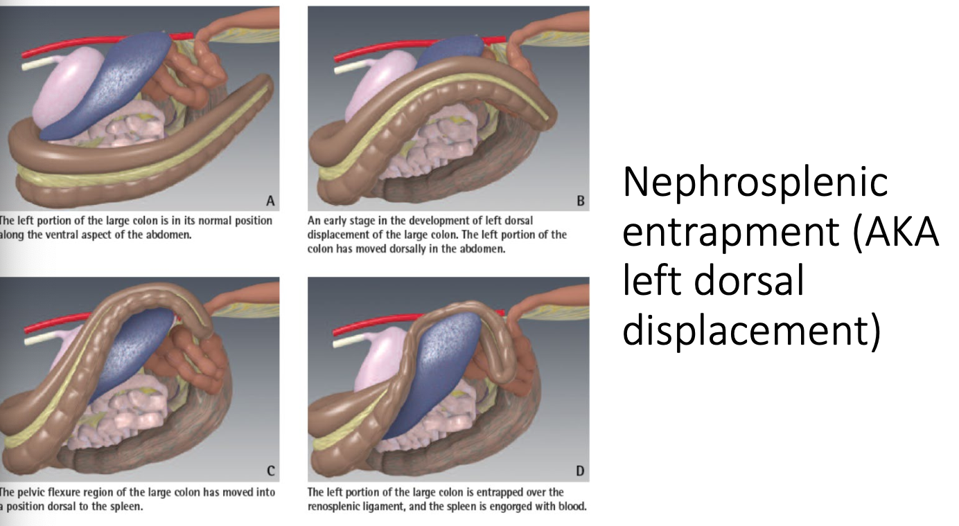 <p>based on configurations of the displacement relative to where the left colon has moved:</p><p>-nephrosplenic entrapment (left dorsal displacement)</p><p>-right dorsal displacement</p><p>-cranial displacement of left colon</p>