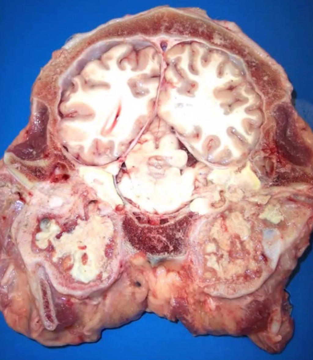 <p>Calf. What is the etiology?</p><p>A-Mycop/asma bovis</p><p>B-Mycobacterium bovis</p><p>C-Pasteurel/a multocida</p><p>D-Hemophi/us somni</p>