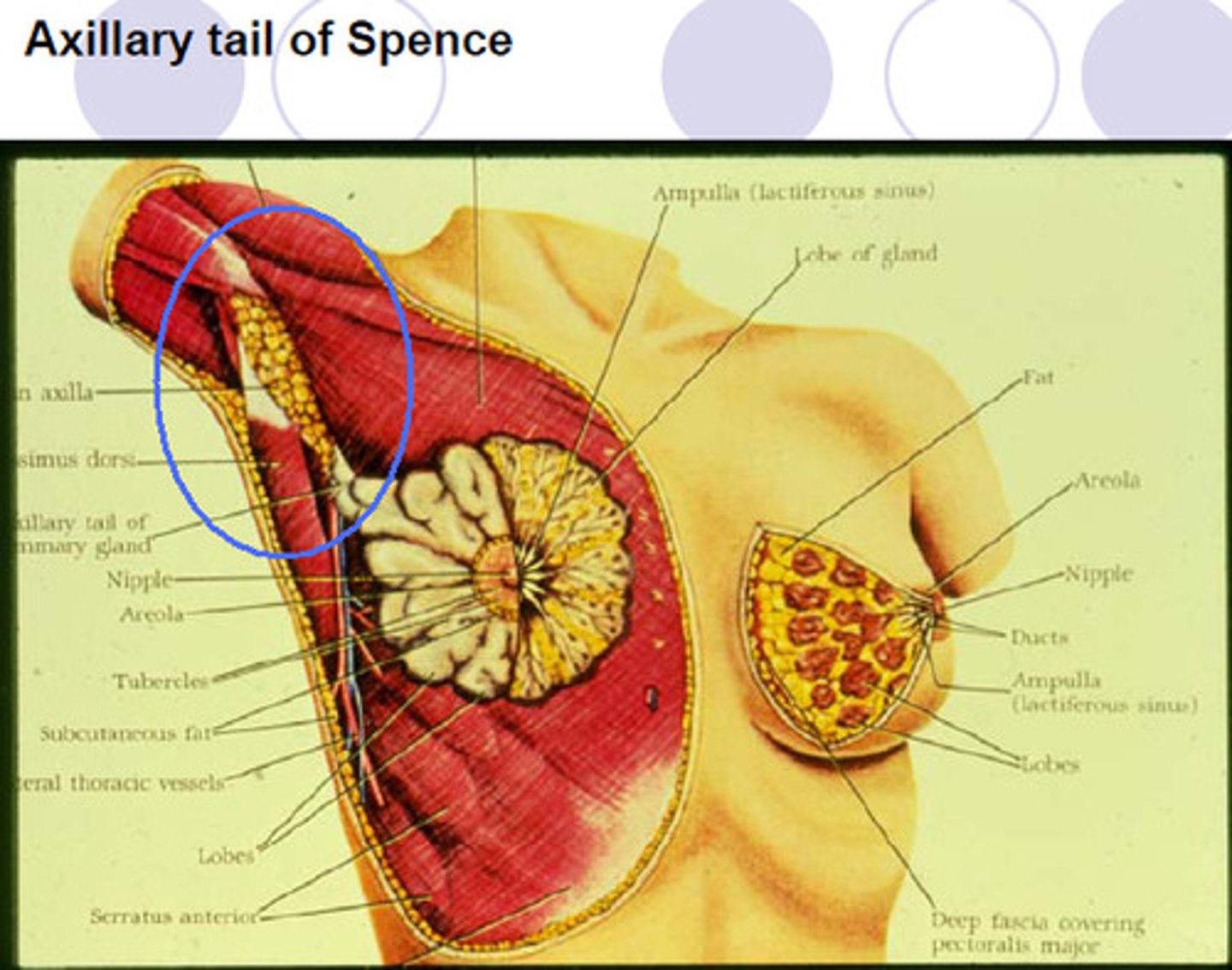 <p>superior lateral corner of breast tissue, projects up and laterally into axilla</p>