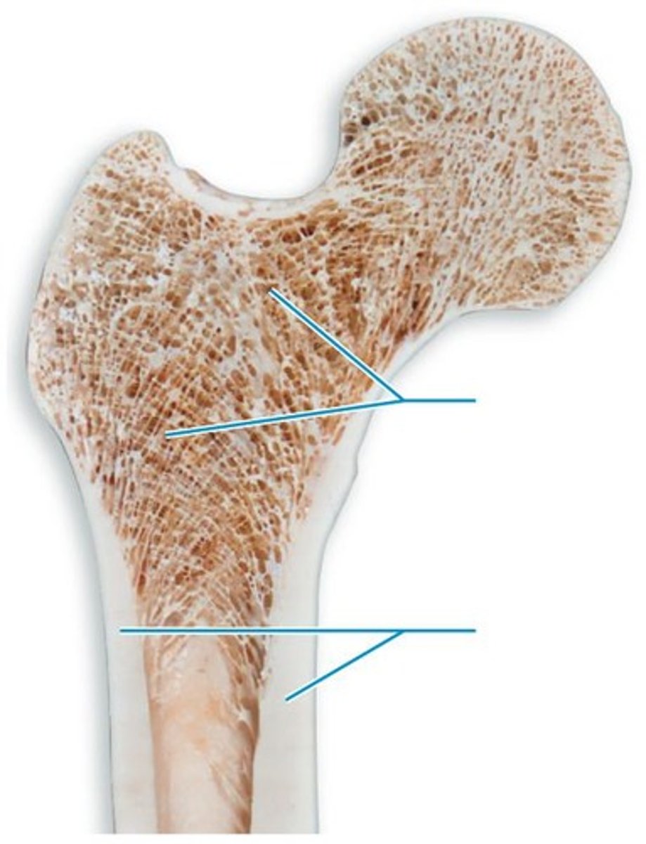 <p>Bone that has a mesh of bony spines called trabeculae.</p>