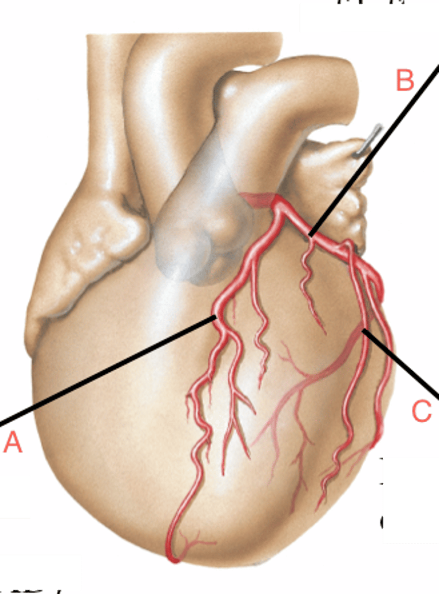 <p>(C)</p>