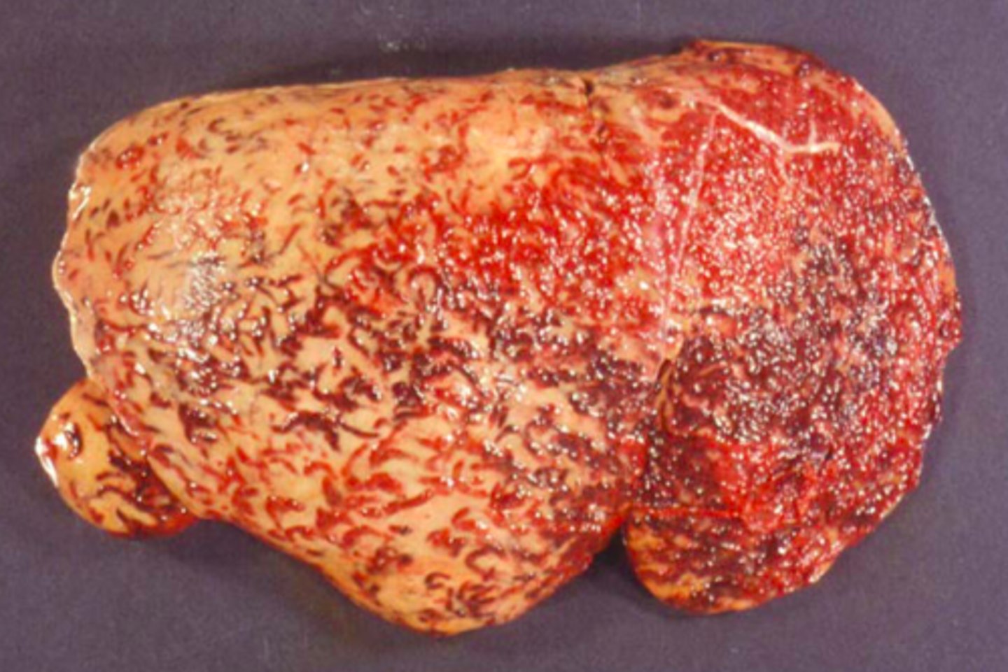 <p>Lever fra får, hvad er den patoanatomiske diagnose og ætiologien?</p>