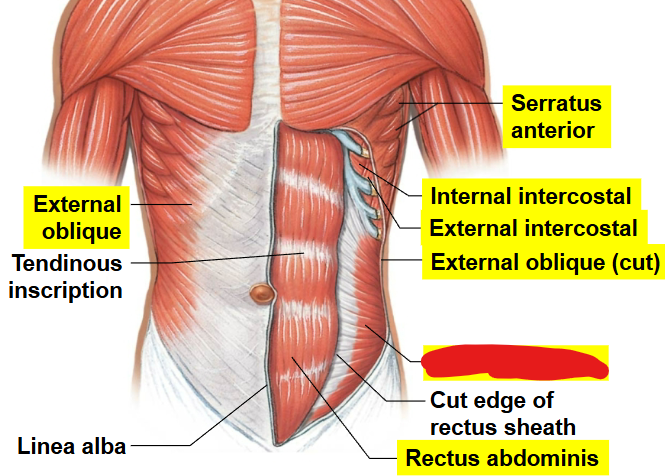 <p>What muscle is this?</p>