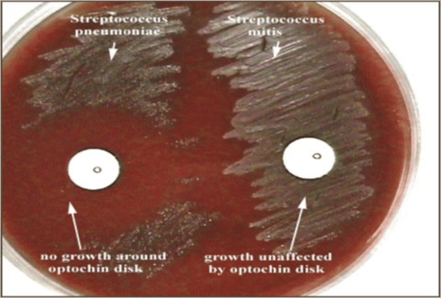 <p>-Optochin</p><p>-Distinguishes Strep pneumoniae</p><p>-10-12 mm</p>