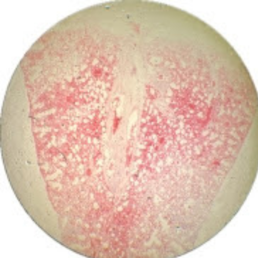 term image